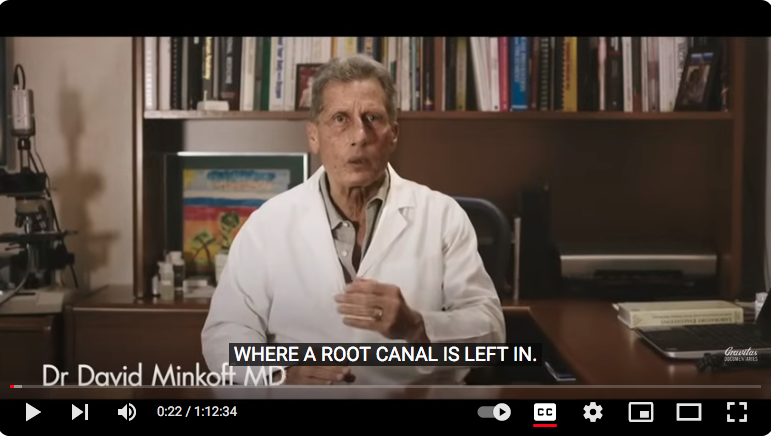 The Root Cause Movie